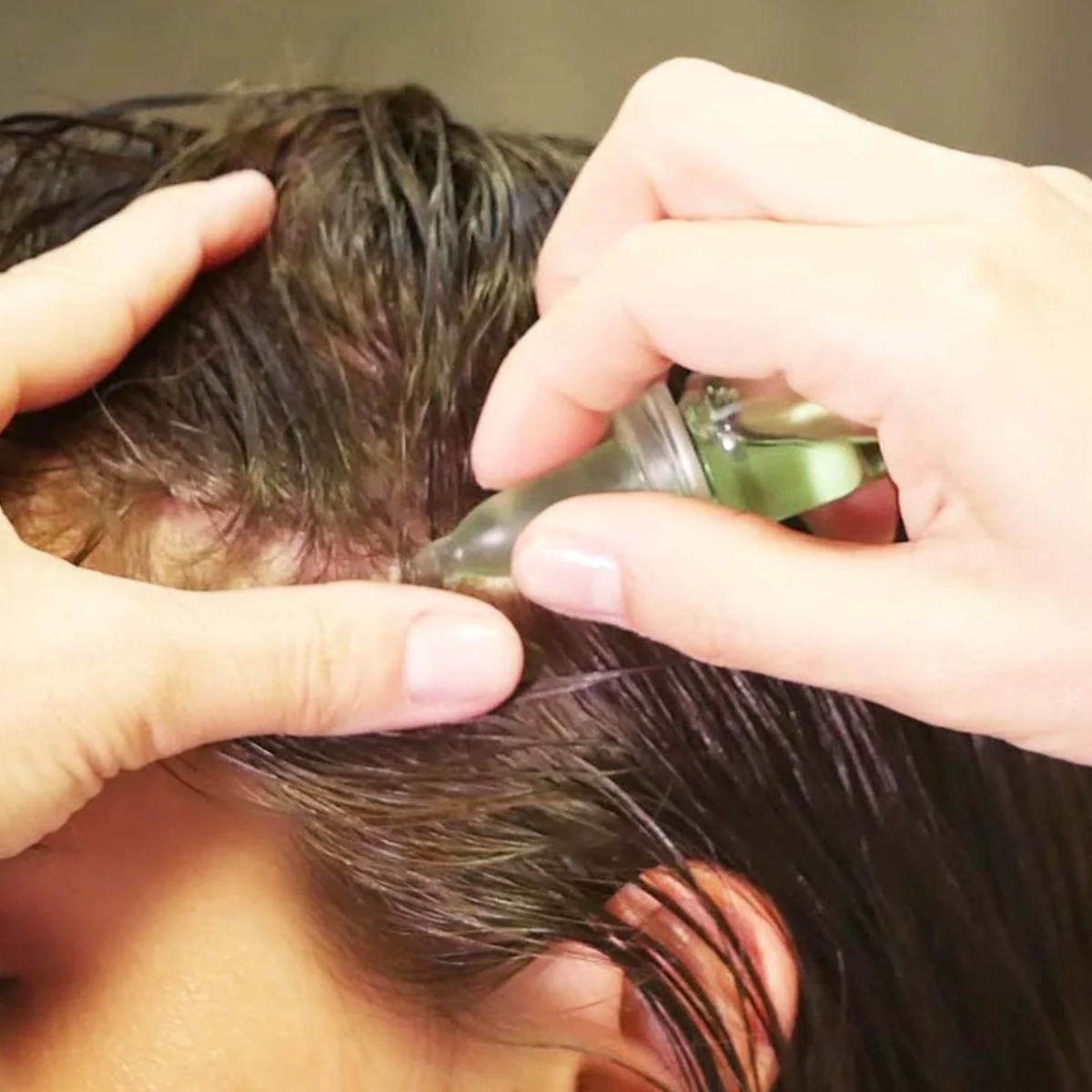 Wiohair Ampollas Stop Caída 14 ud–Logiservice Farma