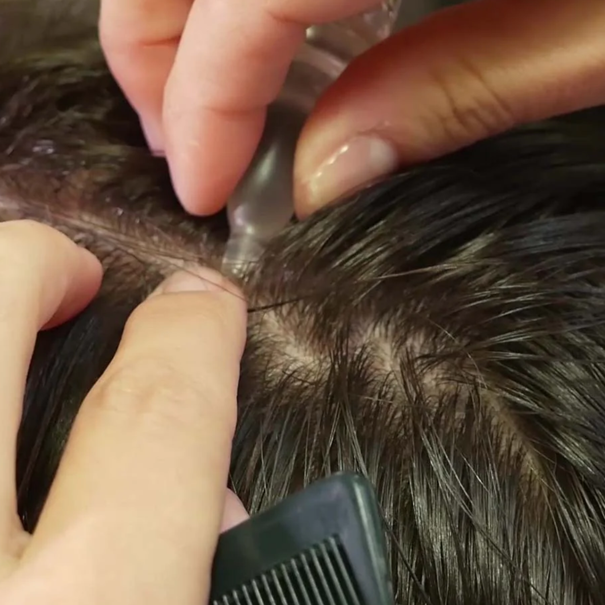 Wiohair Ampollas Stop Caída 14 ud–Logiservice Farma